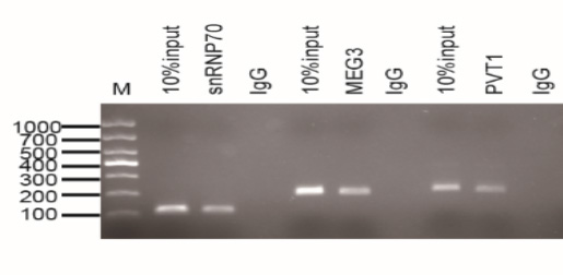 RNA-RNA pull-down产物q-pcr跑胶.jpg