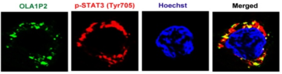 RNA-蛋白FISH结果图.png